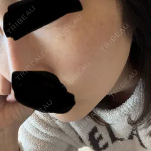 さっぽろ美容クリニック口コミ