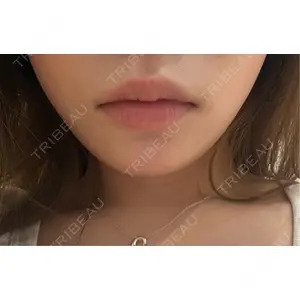 プロクリニック PRO CLINIC プロクリニック 銀座院口コミ