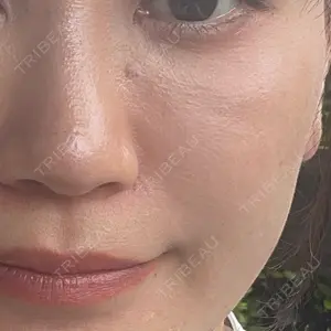 口コミ