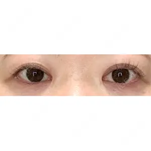 東京イセアクリニック口コミ