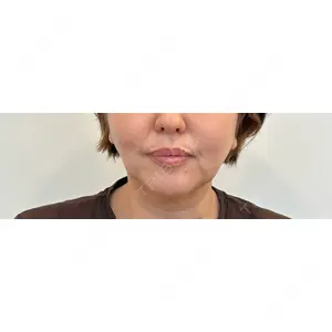 RIVER CLINIC RIVER CLINIC（リバークリニック）口コミ