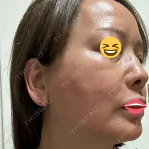 LIFIX BEAUTY CLINIC口コミ
