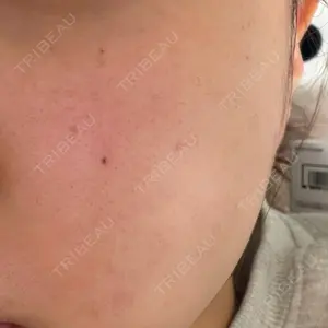 ルラ美容クリニック ルラ美容クリニック 横浜院口コミ