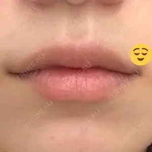 HAAB CLINIC HAAB×DREAM BEAUTY CLINIC 東京本院口コミ