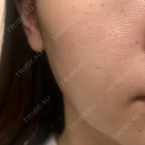 ルラ美容クリニック ルラ美容クリニック銀座院口コミ