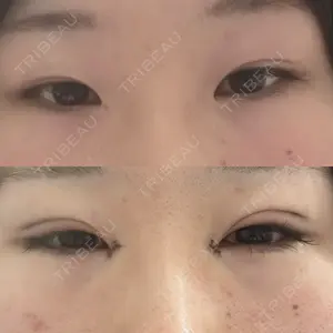 口コミ