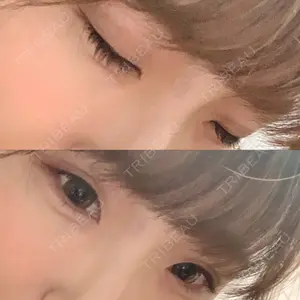 TCB東京中央美容外科 TCB東京中央美容外科 心斎橋筋院口コミ