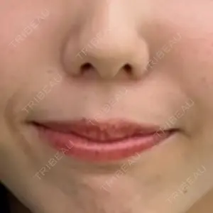 ルラ美容クリニック ルラ美容クリニック 渋谷本院口コミ