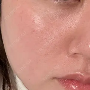 さっぽろ美容クリニック口コミ