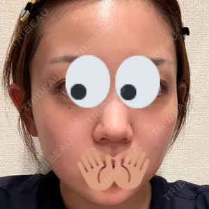 APスキンクリニック銀座口コミ