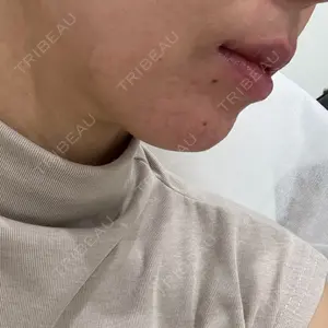 プライベートスキンクリニック 梅田本院口コミ