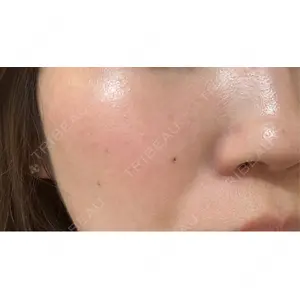 やさしい美容皮膚科・皮フ科 やさしい美容皮膚科・皮フ科　東京浅草院口コミ