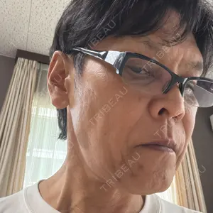 TCB東京中央美容外科 TCB東京中央美容外科 豊田院口コミ
