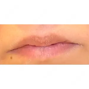 LOUIS CLINIC 二子玉川院【ルイクリニック】口コミ