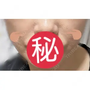 プロクリニック PRO CLINIC プロクリニック 銀座院口コミ