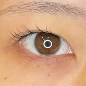 ルラ美容クリニック ルラ美容クリニック 名古屋本院口コミ