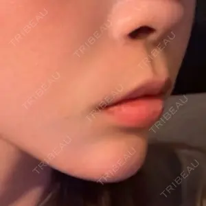 口コミ