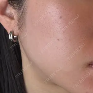HAAB CLINIC HAAB BEAUTY CLINIC 名古屋院口コミ