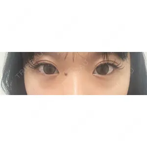 HAAB CLINIC HAAB CLINIC 池袋院口コミ
