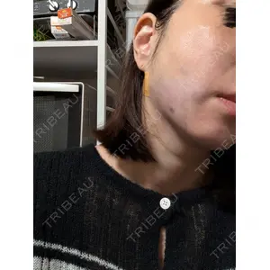 プロクリニック PRO CLINIC プロクリニック 銀座院口コミ