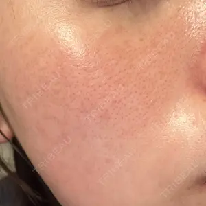 ミニマムスキンクリニック ミニマムスキンクリニック銀座口コミ