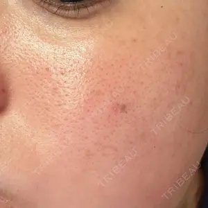 ミニマムスキンクリニック ミニマムスキンクリニック銀座口コミ