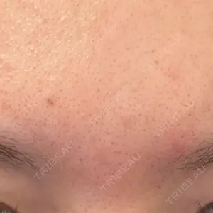 ミニマムスキンクリニック ミニマムスキンクリニック銀座口コミ