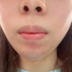 銀座CherijeClinic 銀座CherijeClinic口コミ
