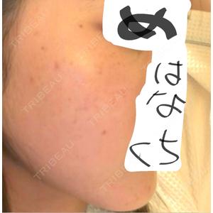 ルラ美容クリニック ルラ美容クリニック 札幌大通り院口コミ