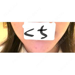 ルラ美容クリニック ルラ美容クリニック 札幌大通り院口コミ