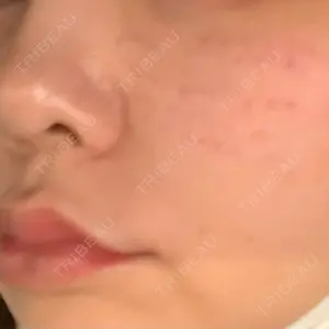 ミニマムスキンクリニック ミニマムスキンクリニック銀座口コミ