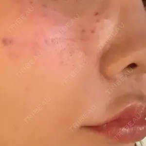 ミニマムスキンクリニック ミニマムスキンクリニック銀座口コミ