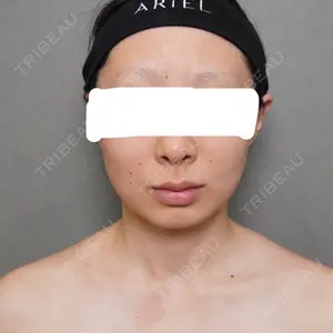 アリエル美容クリニック アリエル美容クリニック 大宮院口コミ