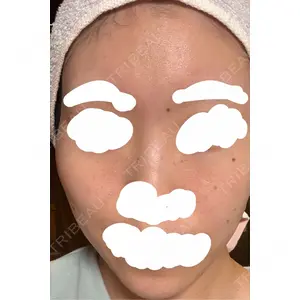 フォンタナクリニック天神口コミ