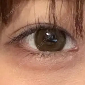 白金ビークリニック 本院口コミ