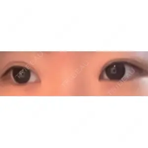 フィラークリニック フィラークリニック 大阪心斎橋院口コミ