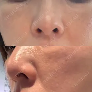 ミニマムスキンクリニック ミニマムスキンクリニック銀座口コミ