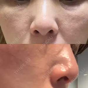 ミニマムスキンクリニック ミニマムスキンクリニック銀座口コミ