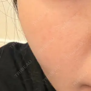 おおたかの森ビューティークリニック おおたかの森ビューティークリニック口コミ