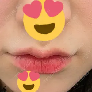 新未来クリニック口コミ