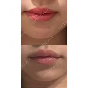 BITO BEAUTY CLINIC BITO BEAUTY CLINIC口コミ