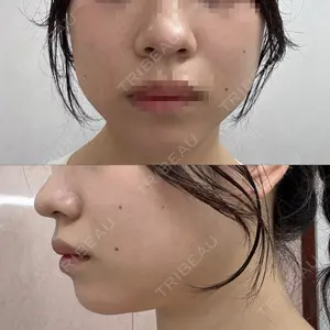 口コミ