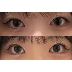 プロミス整形外科口コミ