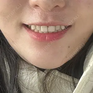 HAAB CLINIC HAAB CLINIC 池袋院口コミ