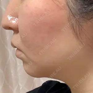 HAAB CLINIC HAAB CLINIC 池袋院口コミ