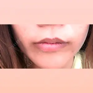 白金ビークリニック 本院口コミ