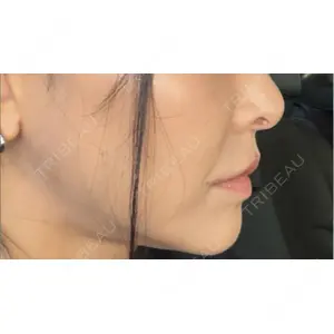 LA CLEF CLINIC（ラクレクリニック）口コミ