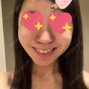 口コミ
