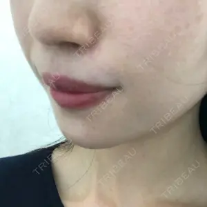HAAB CLINIC HAAB CLINIC 池袋院口コミ