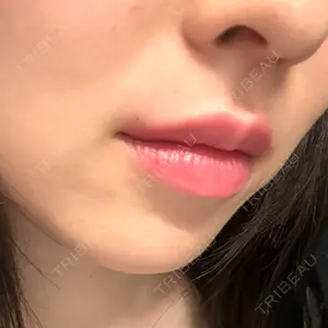 プロクリニック PRO CLINIC プロクリニック 銀座院口コミ